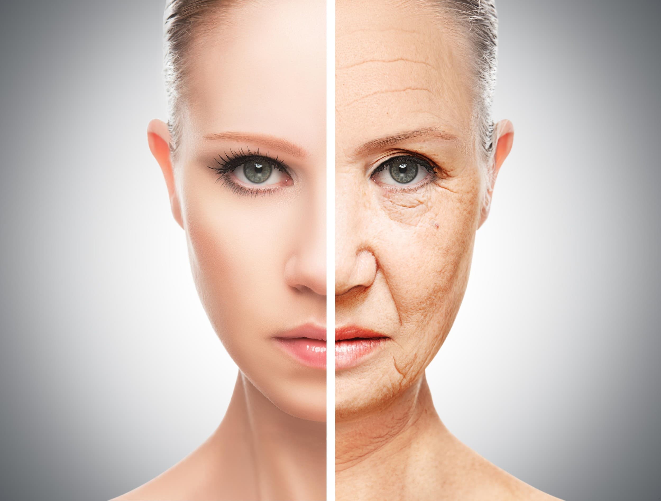 Profhilo - anti-aging hoito | Helsinki | Elamyslahjat